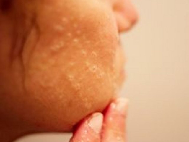 How To Clean Facial Pores 66