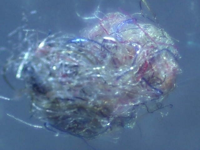 Lint, magnified.
