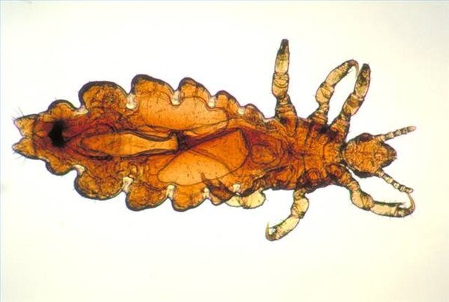 Head lice (Pediculus humanus capitis)