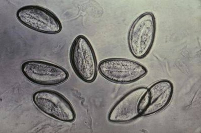 A magnified view of pinworm eggs.