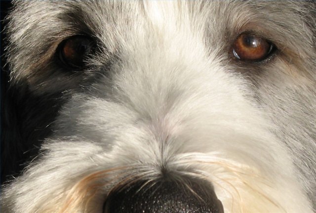 Cushing's disease is often misdiagnosed