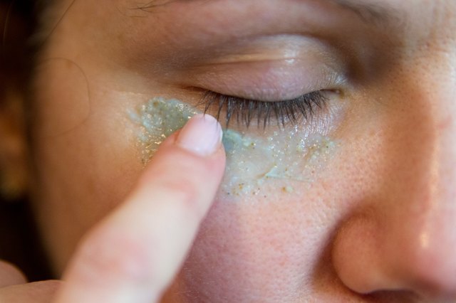 how-to-get-rid-of-milia-under-the-eye-with-pictures-ehow