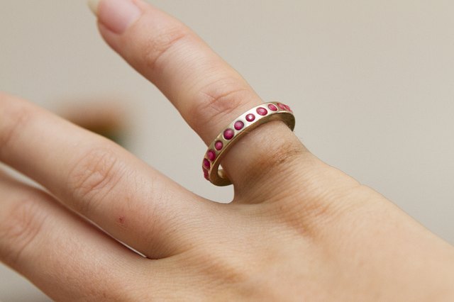 jewelry reaction skin wedding ring
