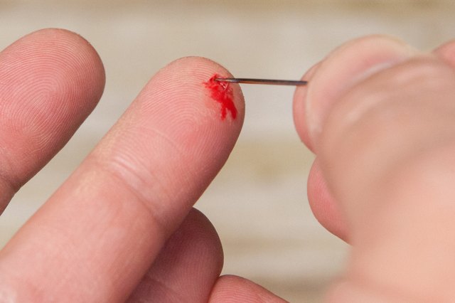 How To Remove A Piece Of Glass From A Finger With Pictures Ehow