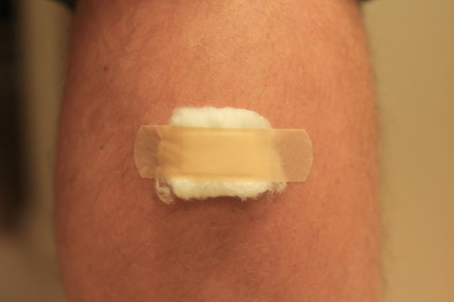 how-to-get-rid-of-leg-scars-caused-by-picking-at-scabs-ehow