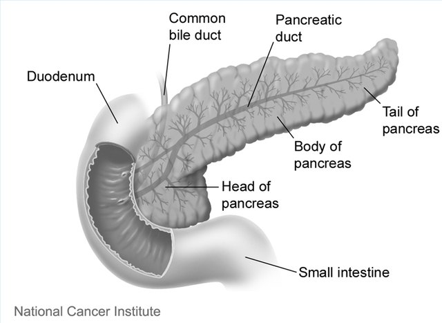 what are the stages of pancreatic Stage 4 pancreatic cancer has spread from the pancreas into other organs in the body though it's the most advanced stage, there are still treatment options understand the stages, progression . what are the stages of pancreatic Stage 4 pancreatic cancer has spread from the pancreas into other organs in the body though it's the most advanced stage, there are still treatment options understand the stages, progression .
