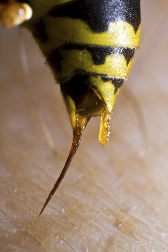 Stinging