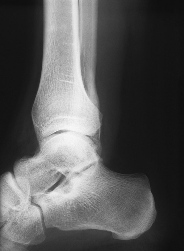 Ankle