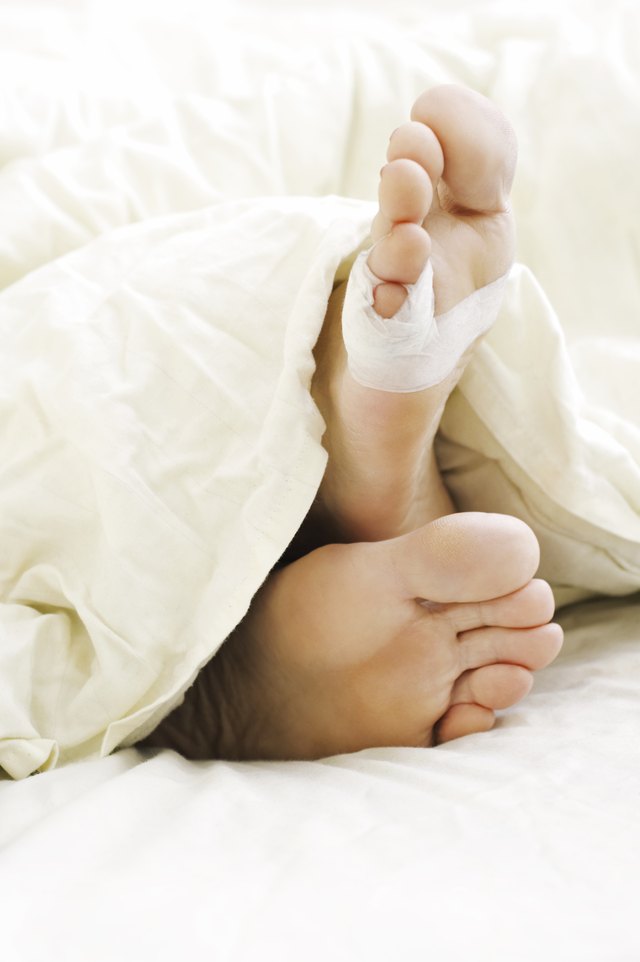 Tape is used to hold a toe in place after phalangeal surgery.