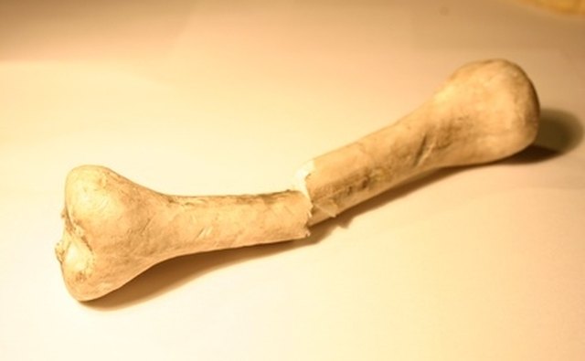 Cortical screws hold the outer bone tissue.