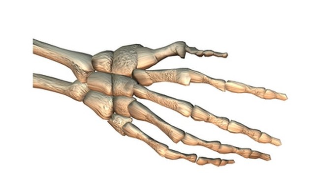 The acutrak screw holds carpal wrist bone fractures.