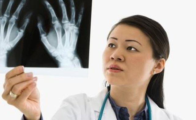 Bone age is determined by an x-ray of the left hand and wrist.
