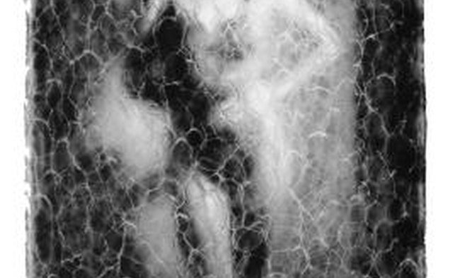 Distorted body image may be a warning sign.