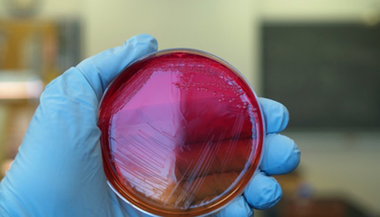 Bacteria Colonies image by ggw from Fotolia.com