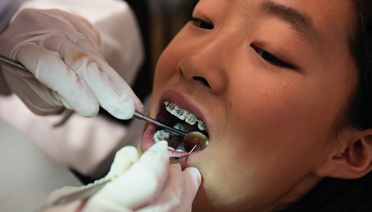 Girl at the Orthodontist Getting Braces