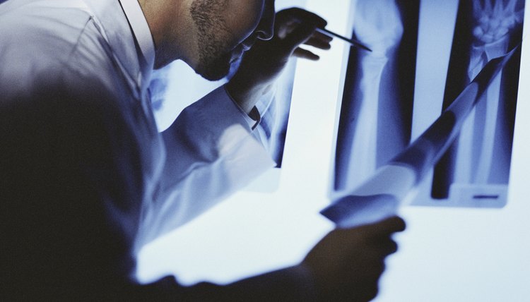 Male doctor examining an X-ray