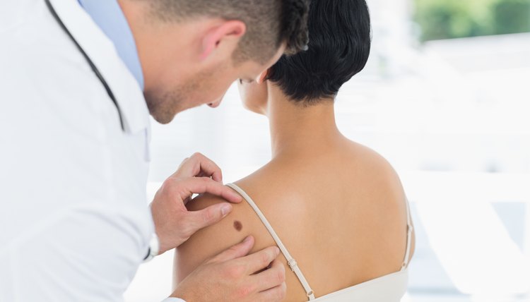Doctor examining mole on back of woman