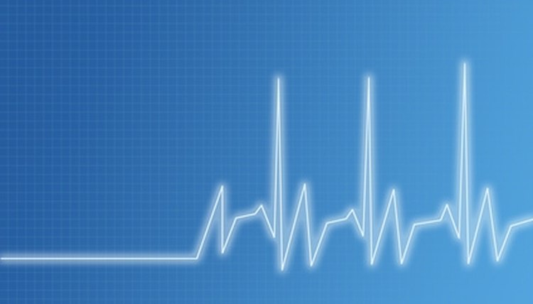 Medical assistants can recognize and report abnormal rhythms.