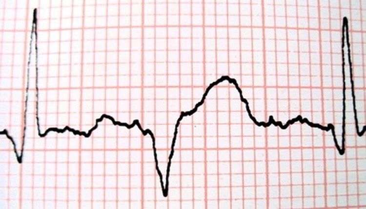 High school students can experiment to determine how listening to a heartbeat affects their own heartbeats.