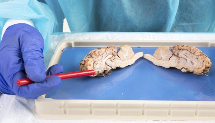 A neuroscience student dissects brain tissue in a lab