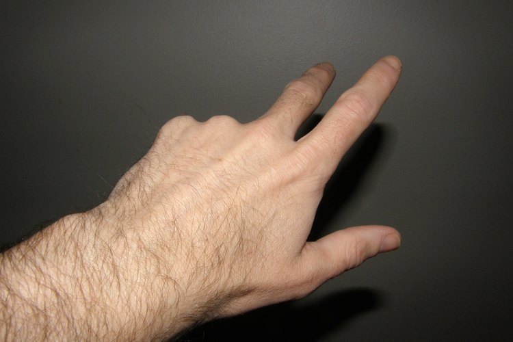 El dolor en la muñeca puede significar un esguince.