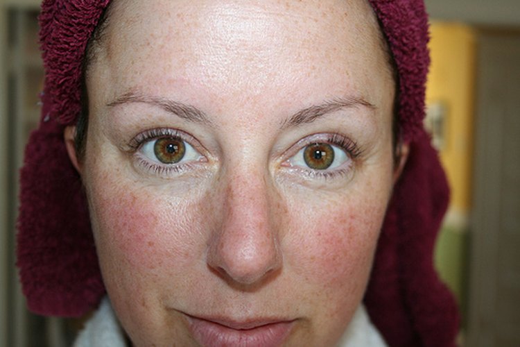 Enrojecimiento facial.
