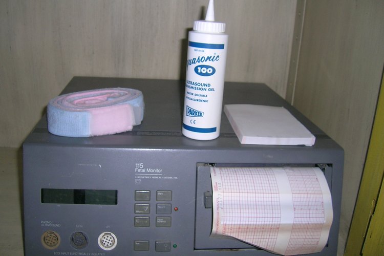 Aparato electrónico de monitoreo fetal.