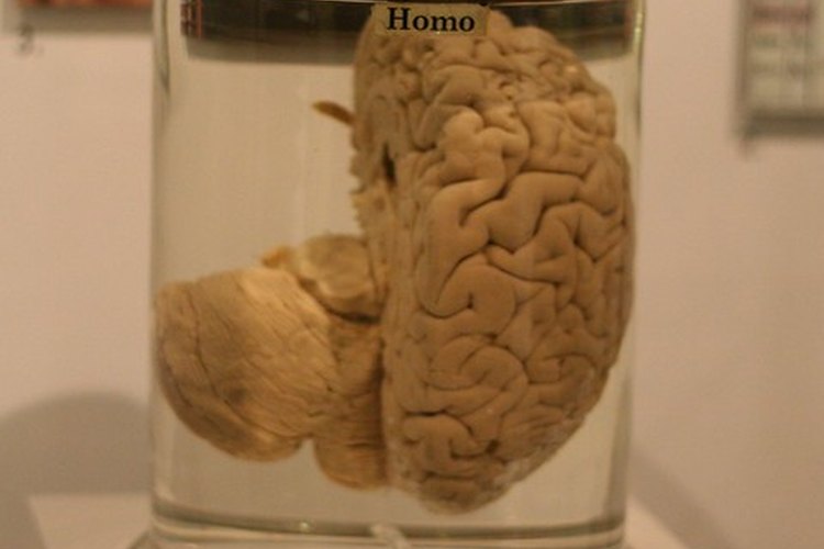 La epilepsia es una enfermedad del cerebro.