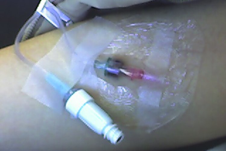 Las infecciones del tracto urinario por Pseudomonas pueden requerir tratamiento con drogas intravenosas.