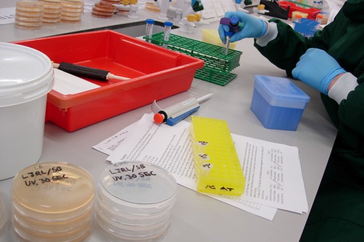 La TFG es un estimado, basado en los resultados de otras pruebas de sangre de funcionamiento renal.