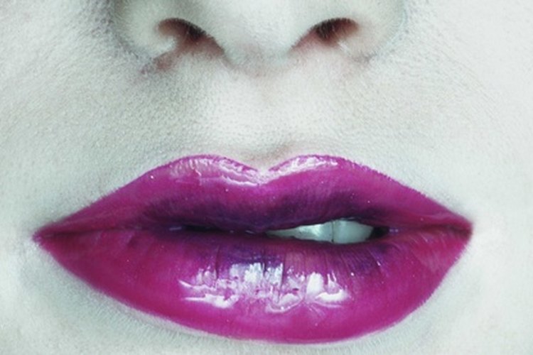El rellenador dérmico Juvederm puede alisar las arrugas de los labios.