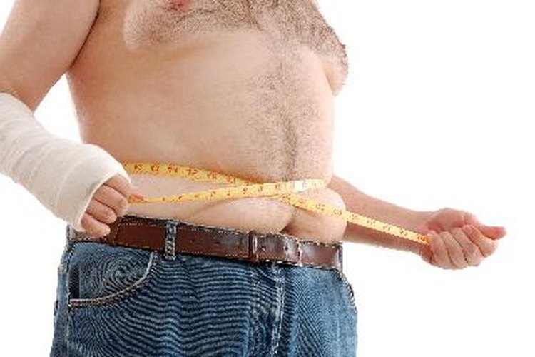 La obesidad es una de las causas de la joroba de búfalo.