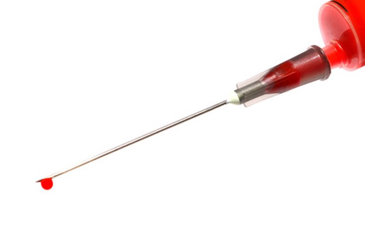 Un análisis determinará los niveles de SGOT en la sangre.