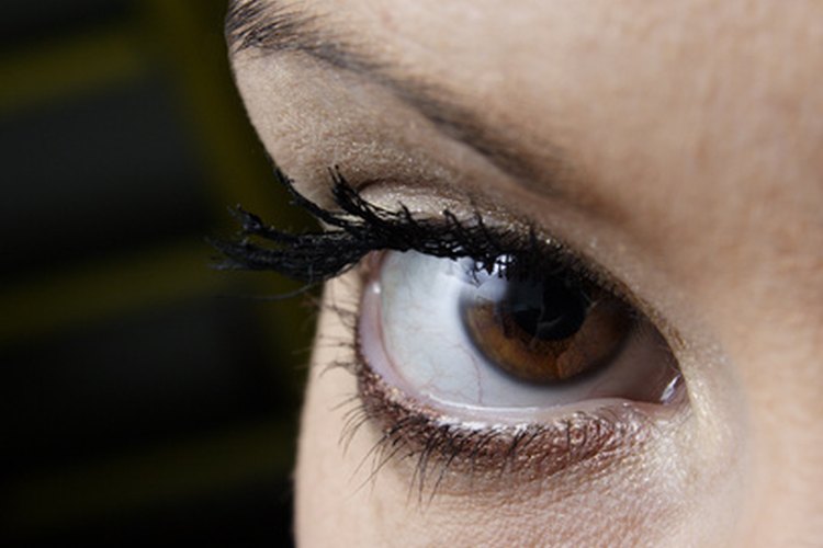 Los vasos sanguíneos rotos en los ojos pueden resultar por numerosas causas.