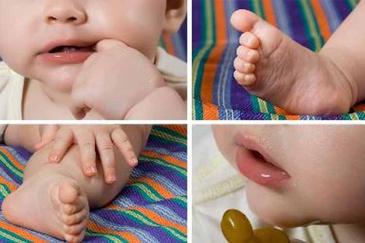Los milia aparecen comúnmente en la piel de los bebés.