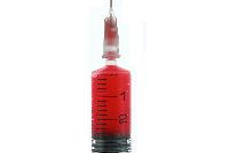 La hiperlipidemia es un termino genérico para niveles anormalmente altos de lípidos en la sangre, incluyendo colesterol y triglicéridos.