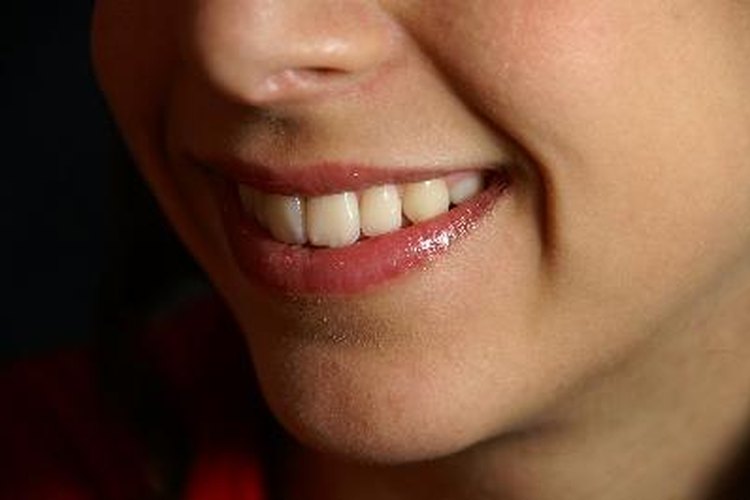 El tratamiento consiste en placas alineadoras casi invisibles que pones sobre tus dientes.
