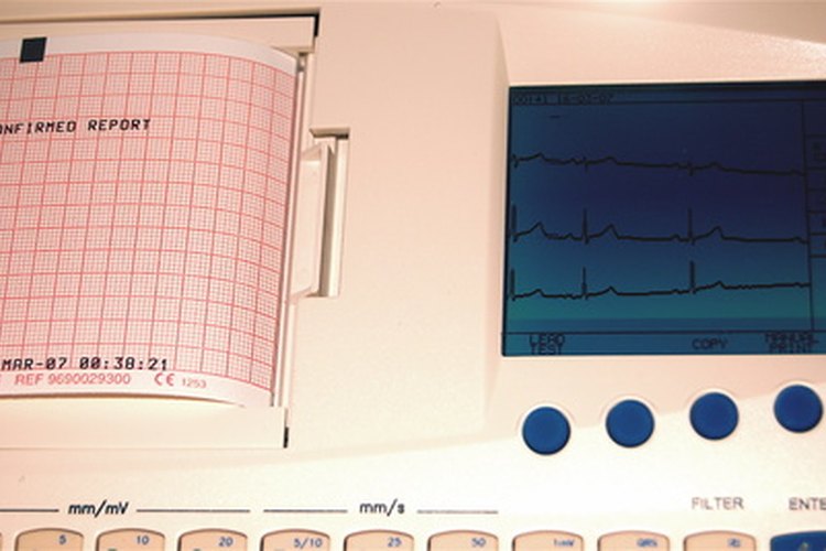 El dolor de pecho y espalda puede ser un síntoma de ataque cardíaco.