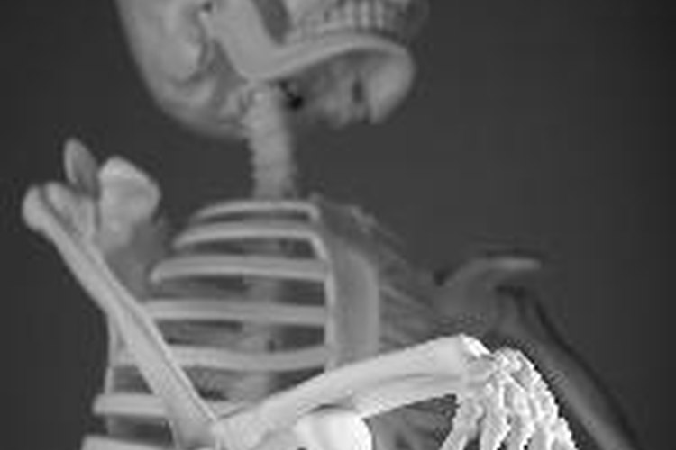 Espondilosis cervical