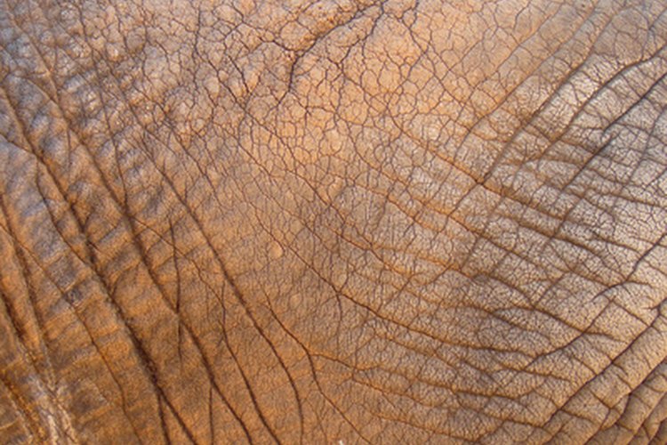 Las pieles secas son susceptibles a este tipo de eczema