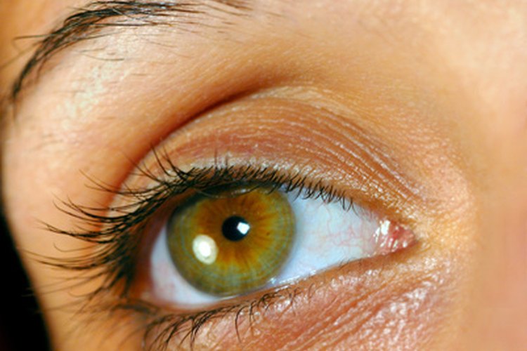 La conjuntivitis es una enfermedad que se contagia muy fácilmente.