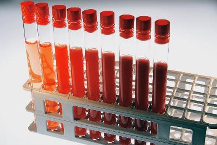 Los niveles normales de neutrófilos son entre 2500 y 6000 por mm3 (milímetro cúbico) de sangre.