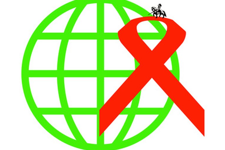 Existen cinco estados de la infección con HIV, siendo la última el SIDA.
