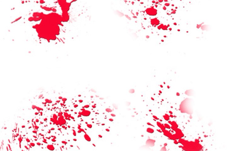 Sangre MPV alta.