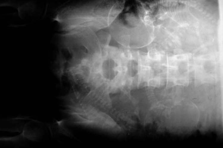 Al descender en la pelvis, tu bebé se está preparando para nacer.