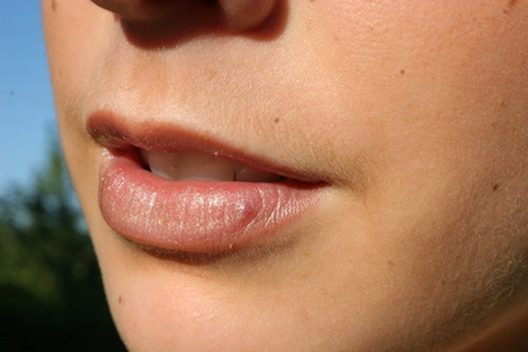 Hay muchos métodos para minimizar y eliminar el vello facial.