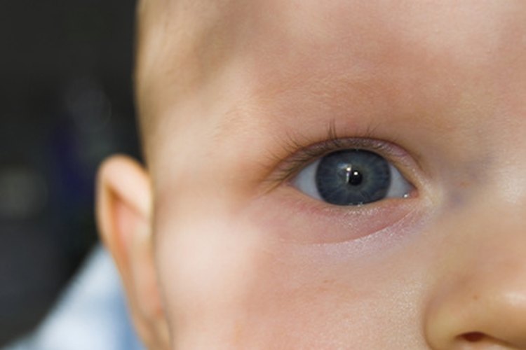 El movimiento involuntario de los ojos puede aparecer al nacer o a temprana edad.