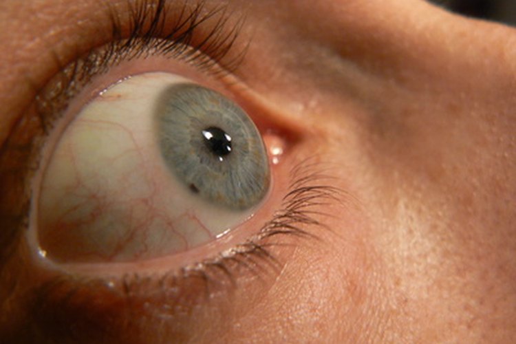 Las enfermedades oculares pueden ser hereditarias.