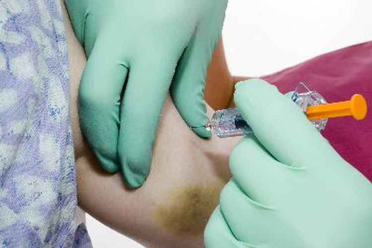 Independientemente de la variedad de púrpura, existe un tratamiento médico de fácil acceso.