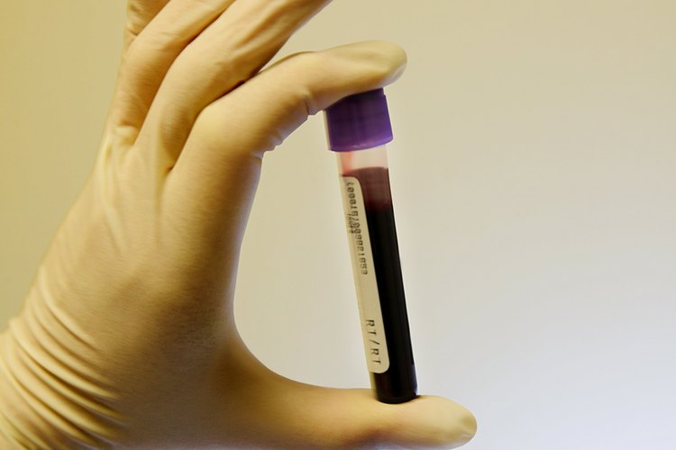 La dopamina generalmente se mide en un análisis de sangre.